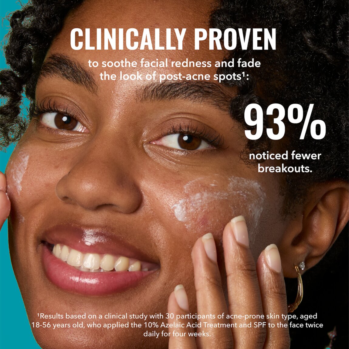 10-azelaic-acid-treatment-k9 zb_p.jpg