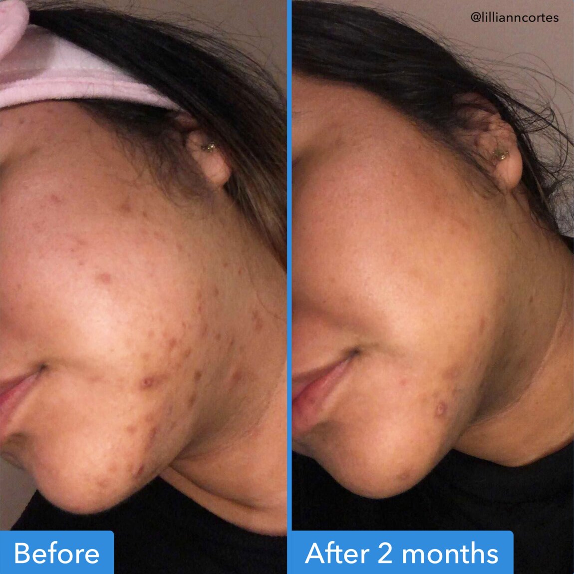 discoloration-correcting-serum-k1 zb_p.jpg
