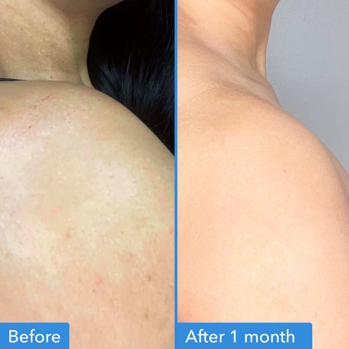 discoloration-correcting-body-treatment-d2 zb_p.jpg