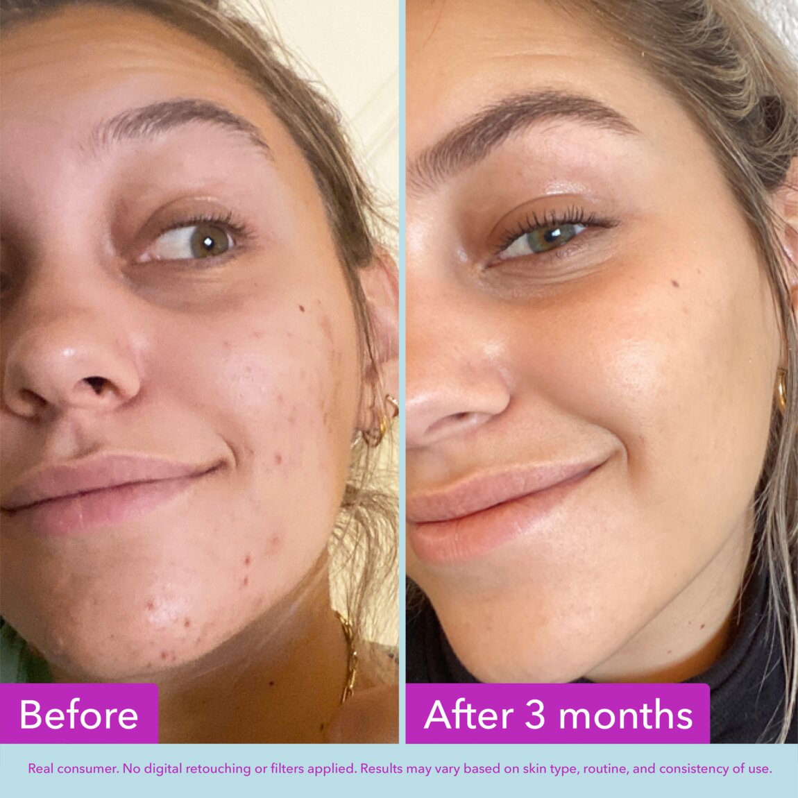 niacinamide-brightening-toner-t0 zb_p.jpg